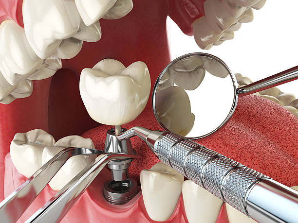 Best Pediatric Emergency Dentist in Uhrichsville, OH